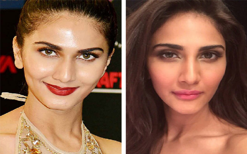 vaani-kapoor-lip-surgery